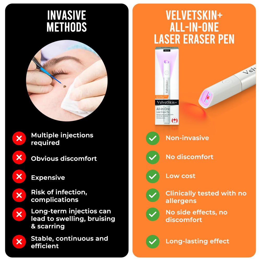 ☂DedMuller® VelvetSkin+Series ⚔️All-in-One Laser Eraser Pen🖊️ (🔬Powered by CO₂ laser technology – effectively removes moles, warts, skin tags, pigmentation spots, and other skin imperfections)